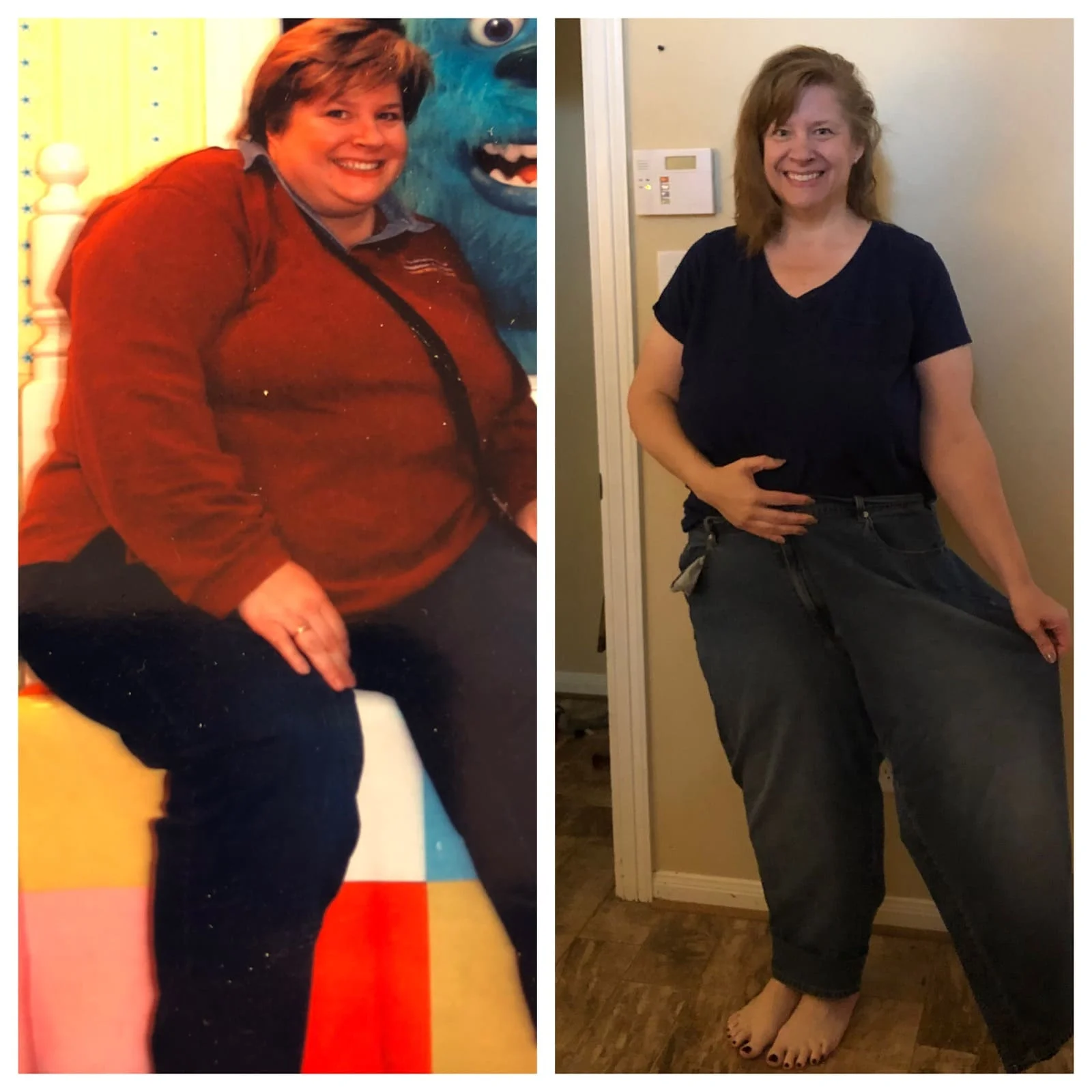 Weight Loss Surgery Before and After Kathryn A - 12 Month Update*